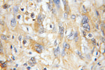 NMT1 Antibody in Immunohistochemistry (Paraffin) (IHC (P))