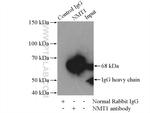 NMT1 Antibody in Immunoprecipitation (IP)