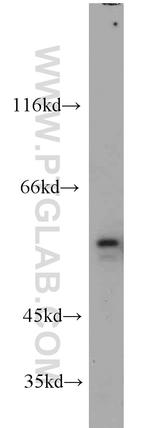 NMT1 Antibody in Western Blot (WB)