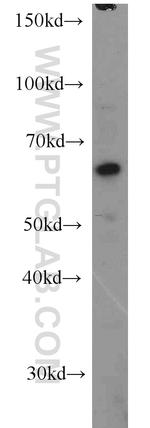 NMT1 Antibody in Western Blot (WB)