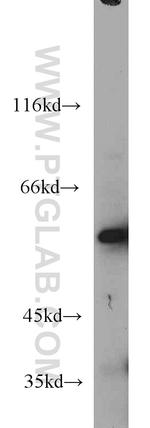 NMT1 Antibody in Western Blot (WB)