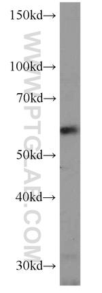 NMT1 Antibody in Western Blot (WB)