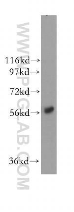 NMT1 Antibody in Western Blot (WB)