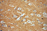 DGKA Antibody in Immunohistochemistry (Paraffin) (IHC (P))