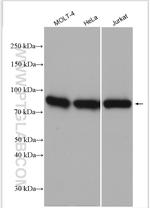 DGKA Antibody in Western Blot (WB)