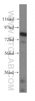 DGKA Antibody in Western Blot (WB)