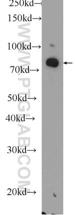 DGKA Antibody in Western Blot (WB)