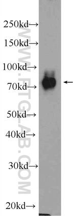 DGKA Antibody in Western Blot (WB)