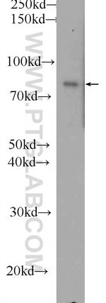 DGKA Antibody in Western Blot (WB)