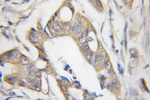 CHRNB1 Antibody in Immunohistochemistry (Paraffin) (IHC (P))