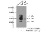 CHRNB1 Antibody in Immunoprecipitation (IP)