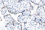 Cyclin E1 Antibody in Immunohistochemistry (Paraffin) (IHC (P))