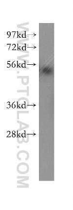 Cyclin E1 Antibody in Western Blot (WB)