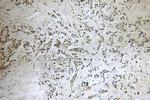 PYGO2 Antibody in Immunohistochemistry (Paraffin) (IHC (P))