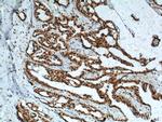 PYGO2 Antibody in Immunohistochemistry (Paraffin) (IHC (P))