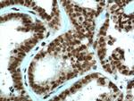 PYGO2 Antibody in Immunohistochemistry (Paraffin) (IHC (P))