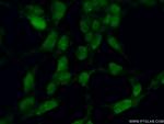 ING2 Antibody in Immunocytochemistry (ICC/IF)