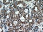 ING2 Antibody in Immunohistochemistry (Paraffin) (IHC (P))