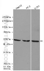 DGAT1 Antibody in Western Blot (WB)