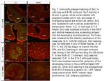 SIX2 Antibody in Immunohistochemistry (IHC)