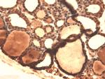 Sodium Iodine Symporter Antibody in Immunohistochemistry (PFA fixed) (IHC (PFA))