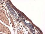 Sodium Iodine Symporter Antibody in Immunohistochemistry (PFA fixed) (IHC (PFA))