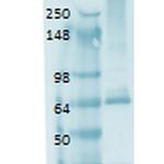 Sodium Iodine Symporter Antibody in Western Blot (WB)