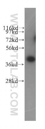 BMSC UbP Antibody in Western Blot (WB)