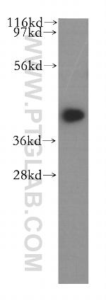 BMSC UbP Antibody in Western Blot (WB)