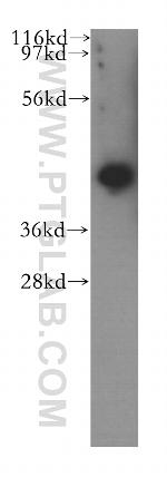 BMSC UbP Antibody in Western Blot (WB)