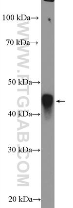 BMSC UbP Antibody in Western Blot (WB)