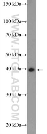 BMSC UbP Antibody in Western Blot (WB)