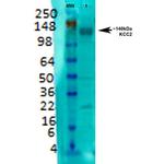 K+/Cl-Cotransporter (KCC2) Antibody in Western Blot (WB)
