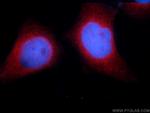 STIM1 Antibody in Immunocytochemistry (ICC/IF)