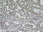 STIM1 Antibody in Immunohistochemistry (Paraffin) (IHC (P))