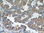 STIM1 Antibody in Immunohistochemistry (Paraffin) (IHC (P))