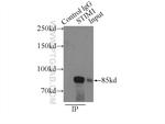 STIM1 Antibody in Immunoprecipitation (IP)