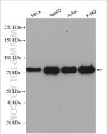 STIM1 Antibody in Western Blot (WB)