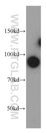 STIM1 Antibody in Western Blot (WB)