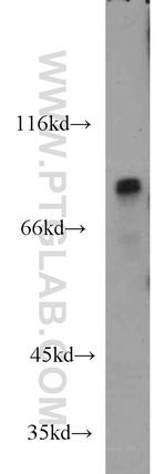 STIM1 Antibody in Western Blot (WB)