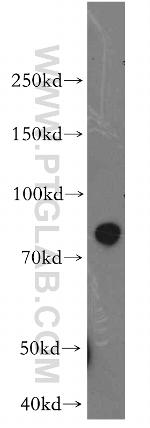 STIM1 Antibody in Western Blot (WB)