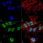 Cav3.1 Ca+2 Channel Antibody in Immunocytochemistry (ICC/IF)