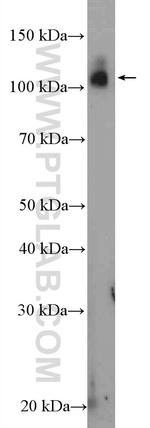 MED15 Antibody in Western Blot (WB)