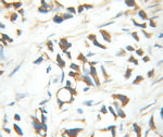 MED15 Antibody in Immunohistochemistry (Paraffin) (IHC (P))