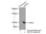 MED15 Antibody in Immunoprecipitation (IP)