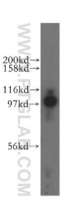 MED15 Antibody in Western Blot (WB)