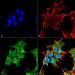 SUR1 Antibody in Immunocytochemistry (ICC/IF)