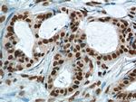 FUS/TLS Antibody in Immunohistochemistry (Paraffin) (IHC (P))