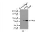 FUS/TLS Antibody in Immunoprecipitation (IP)