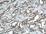 FUS/TLS Antibody in Immunohistochemistry (Paraffin) (IHC (P))